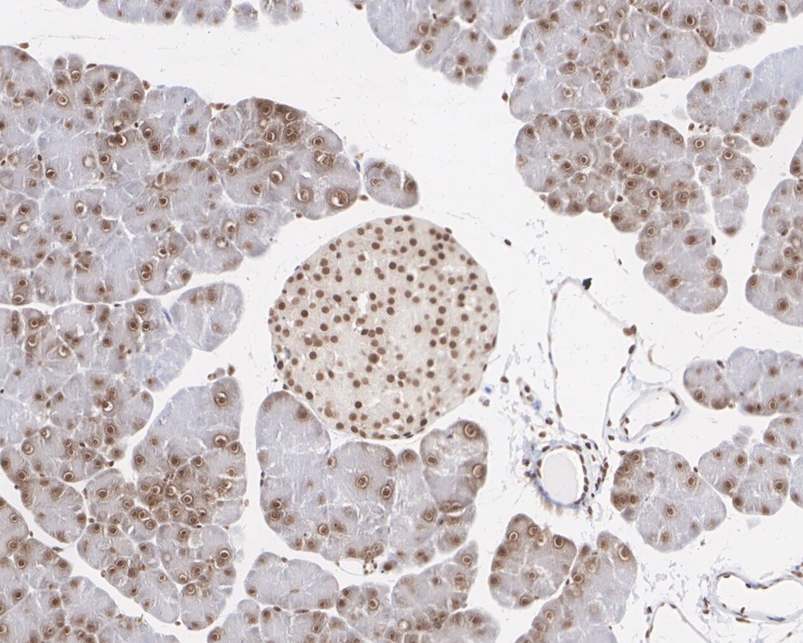 Immunohistochemical analysis of paraffin-embedded mouse pancreas tissue with Rabbit anti-Histone H2A.X antibody (ET1705-97) at 1/4,000 dilution.<br />
<br />
The section was pre-treated using heat mediated antigen retrieval with sodium citrate buffer (pH 6.0) for 2 minutes. The tissues were blocked in 1% BSA for 20 minutes at room temperature, washed with ddH2O and PBS, and then probed with the primary antibody (ET1705-97) at 1/4,000 dilution for 1 hour at room temperature. The detection was performed using an HRP conjugated compact polymer system. DAB was used as the chromogen. Tissues were counterstained with hematoxylin and mounted with DPX.