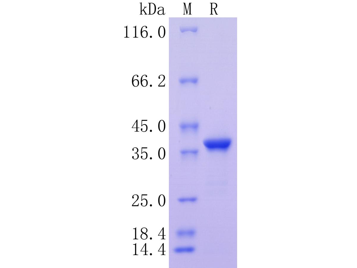 Human Crkl C His Tag Protein Ha Huabio