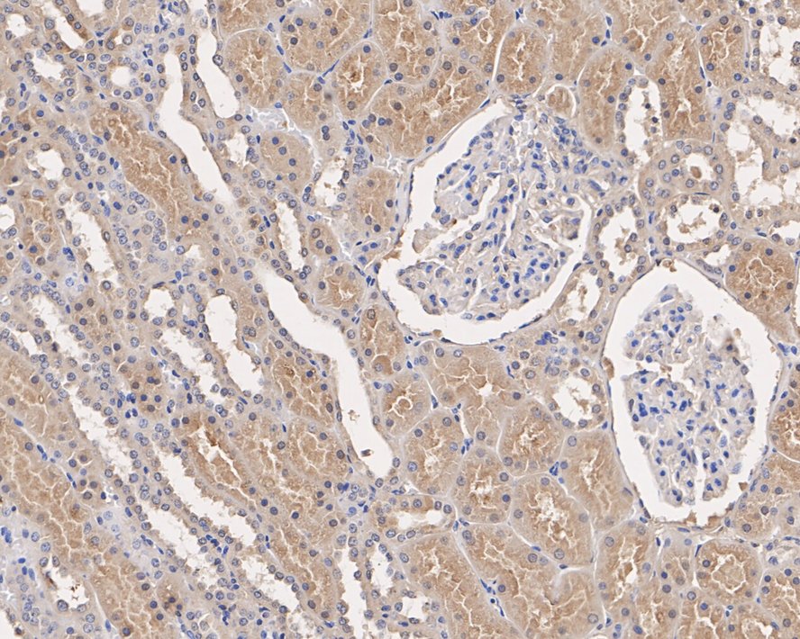 Immunohistochemical analysis of paraffin-embedded human kidney tissue with Mouse anti-Transferrin antibody (M1510-17) at 1/1,000 dilution.<br />
<br />
The section was pre-treated using heat mediated antigen retrieval with Tris-EDTA buffer (pH 9.0) for 20 minutes. The tissues were blocked in 1% BSA for 20 minutes at room temperature, washed with ddH2O and PBS, and then probed with the primary antibody (M1510-17) at 1/1,000 dilution for 1 hour at room temperature. The detection was performed using an HRP conjugated compact polymer system. DAB was used as the chromogen. Tissues were counterstained with hematoxylin and mounted with DPX.