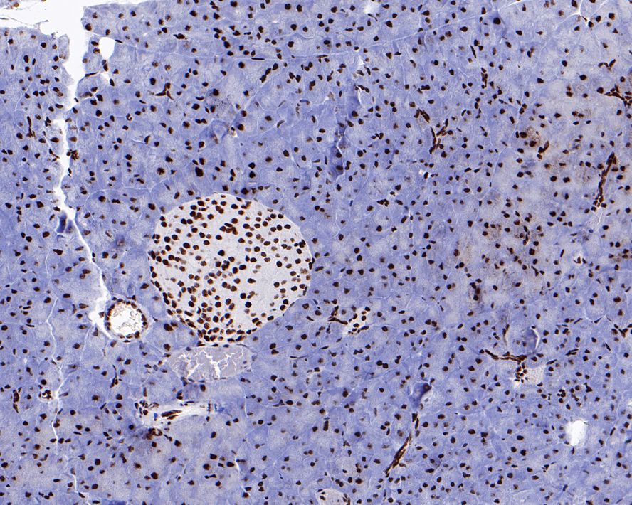 Immunohistochemical analysis of paraffin-embedded mouse lymph nodes tissue with Rabbit anti-HDAC1 antibody (ET1605-35) at 1/800 dilution.<br />
<br />
The section was pre-treated using heat mediated antigen retrieval with sodium citrate buffer (pH 6.0) for 2 minutes. The tissues were blocked in 1% BSA for 20 minutes at room temperature, washed with ddH2O and PBS, and then probed with the primary antibody (ET1605-35) at 1/800 dilution for 1 hour at room temperature. The detection was performed using an HRP conjugated compact polymer system. DAB was used as the chromogen. Tissues were counterstained with hematoxylin and mounted with DPX.