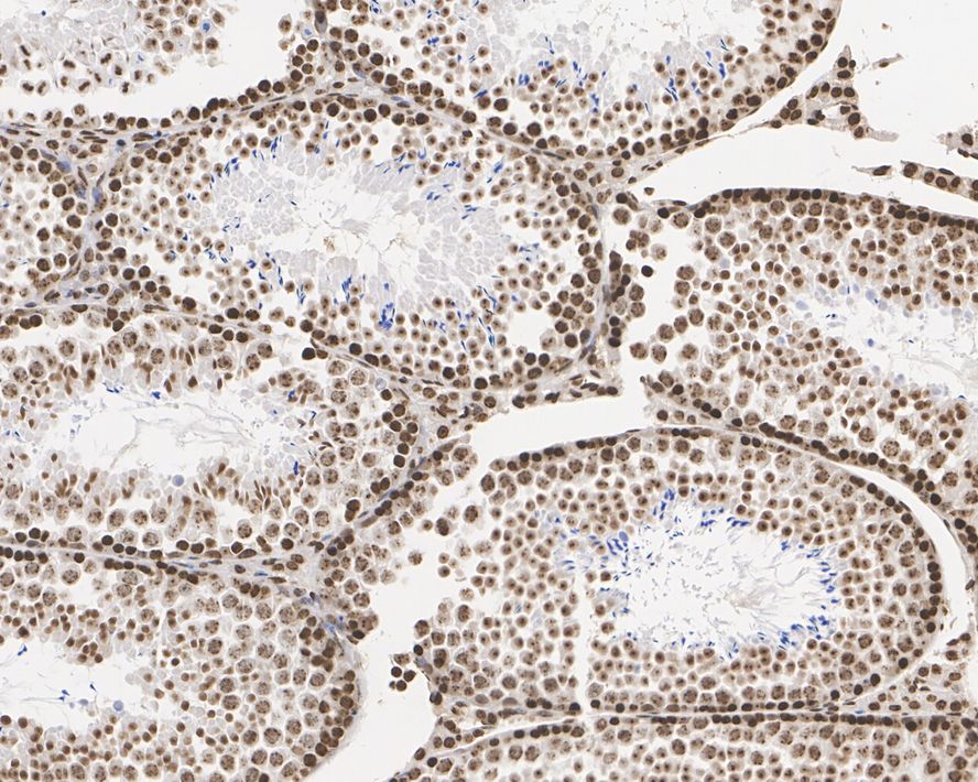 Immunohistochemical analysis of paraffin-embedded human testis tissue with Mouse anti-Histone H3 (tri methyl K9) antibody (M1112-3) at 1/1,000 dilution.<br />
<br />
The section was pre-treated using heat mediated antigen retrieval with sodium citrate buffer (pH 6.0) for 2 minutes. The tissues were blocked in 1% BSA for 20 minutes at room temperature, washed with ddH2O and PBS, and then probed with the primary antibody (M1112-3) at 1/1,000 dilution for 1 hour at room temperature. The detection was performed using an HRP conjugated compact polymer system. DAB was used as the chromogen. Tissues were counterstained with hematoxylin and mounted with DPX.