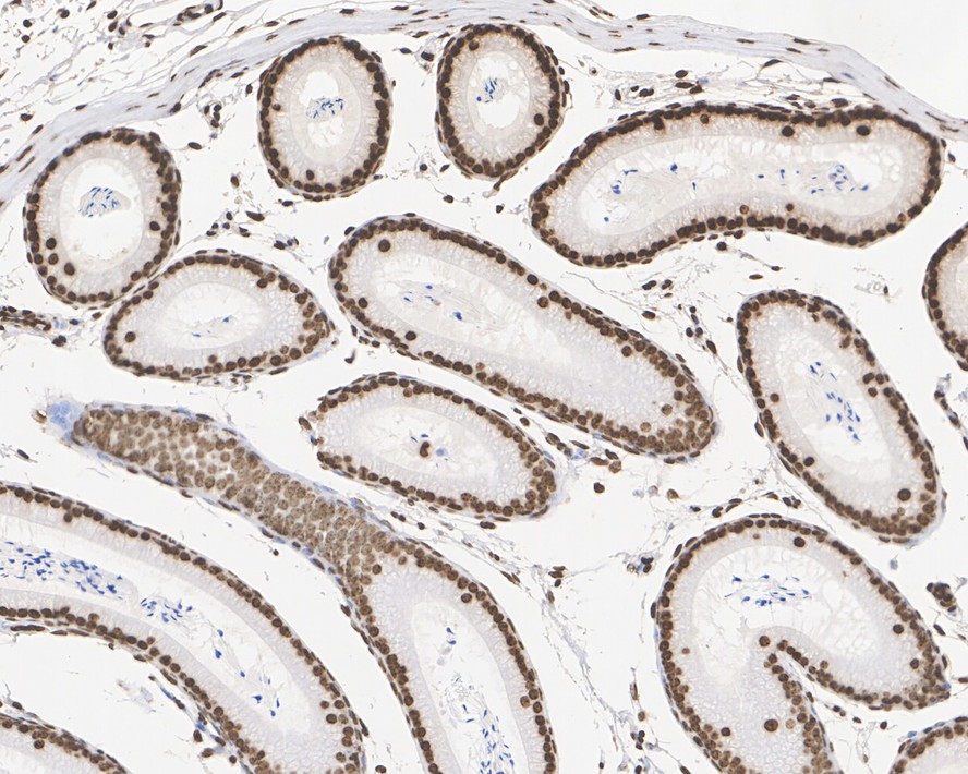 Immunohistochemical analysis of paraffin-embedded mouse testis tissue with Mouse anti-Histone H3 (tri methyl K9) antibody (M1112-3) at 1/1,000 dilution.<br />
<br />
The section was pre-treated using heat mediated antigen retrieval with sodium citrate buffer (pH 6.0) for 2 minutes. The tissues were blocked in 1% BSA for 20 minutes at room temperature, washed with ddH2O and PBS, and then probed with the primary antibody (M1112-3) at 1/1,000 dilution for 1 hour at room temperature. The detection was performed using an HRP conjugated compact polymer system. DAB was used as the chromogen. Tissues were counterstained with hematoxylin and mounted with DPX.