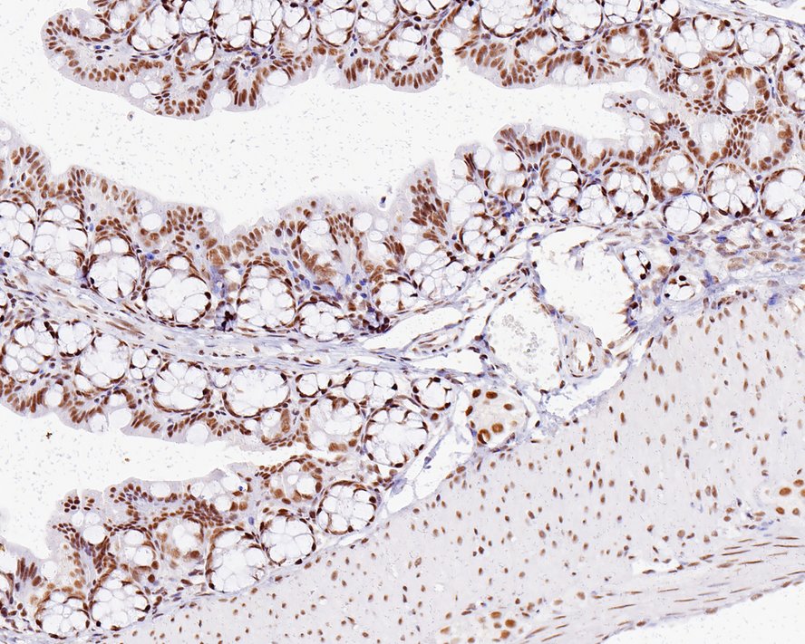 Immunohistochemical analysis of paraffin-embedded mouse colon tissue with Rabbit anti-Cdk9 antibody (ET1612-78) at 1/1,000 dilution.<br />
<br />
The section was pre-treated using heat mediated antigen retrieval with sodium citrate buffer (pH 6.0) for 2 minutes. The tissues were blocked in 1% BSA for 20 minutes at room temperature, washed with ddH2O and PBS, and then probed with the primary antibody (ET1612-78) at 1/1,000 dilution for 1 hour at room temperature. The detection was performed using an HRP conjugated compact polymer system. DAB was used as the chromogen. Tissues were counterstained with hematoxylin and mounted with DPX.