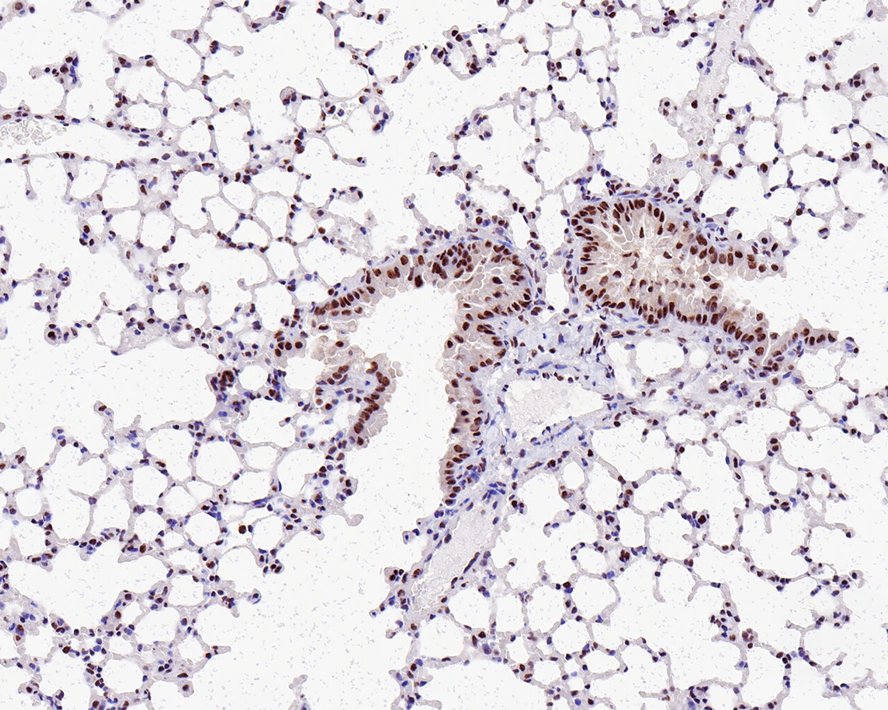 Immunohistochemical analysis of paraffin-embedded mouse lung tissue with Rabbit anti-Cdk9 antibody (ET1612-78) at 1/200 dilution.<br />
<br />
The section was pre-treated using heat mediated antigen retrieval with sodium citrate buffer (pH 6.0) for 2 minutes. The tissues were blocked in 1% BSA for 20 minutes at room temperature, washed with ddH2O and PBS, and then probed with the primary antibody (ET1612-78) at 1/200 dilution for 1 hour at room temperature. The detection was performed using an HRP conjugated compact polymer system. DAB was used as the chromogen. Tissues were counterstained with hematoxylin and mounted with DPX.