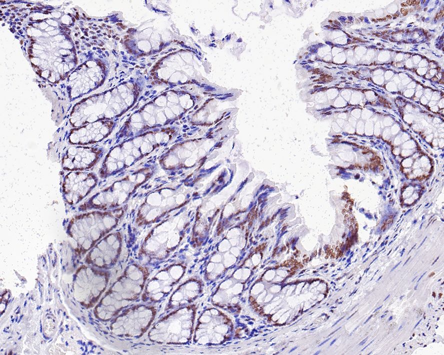 Immunohistochemical analysis of paraffin-embedded rat colon tissue with Rabbit anti-Cdk9 antibody (ET1612-78) at 1/1,000 dilution.<br />
<br />
The section was pre-treated using heat mediated antigen retrieval with sodium citrate buffer (pH 6.0) for 2 minutes. The tissues were blocked in 1% BSA for 20 minutes at room temperature, washed with ddH2O and PBS, and then probed with the primary antibody (ET1612-78) at 1/1,000 dilution for 1 hour at room temperature. The detection was performed using an HRP conjugated compact polymer system. DAB was used as the chromogen. Tissues were counterstained with hematoxylin and mounted with DPX.
