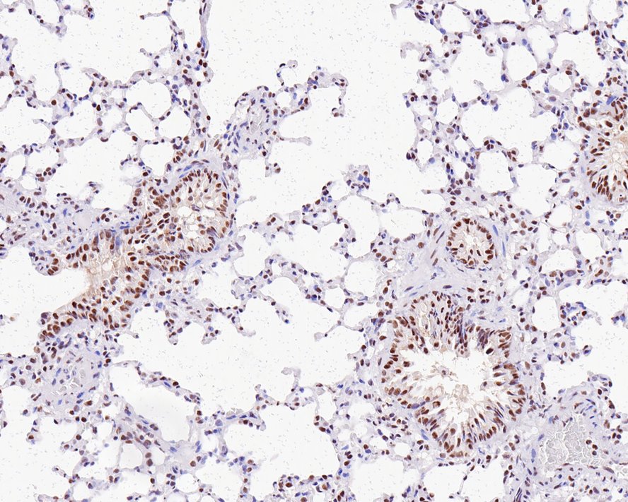 Immunohistochemical analysis of paraffin-embedded rat lung tissue with Rabbit anti-Cdk9 antibody (ET1612-78) at 1/1,000 dilution.<br />
<br />
The section was pre-treated using heat mediated antigen retrieval with sodium citrate buffer (pH 6.0) for 2 minutes. The tissues were blocked in 1% BSA for 20 minutes at room temperature, washed with ddH2O and PBS, and then probed with the primary antibody (ET1612-78) at 1/1,000 dilution for 1 hour at room temperature. The detection was performed using an HRP conjugated compact polymer system. DAB was used as the chromogen. Tissues were counterstained with hematoxylin and mounted with DPX.