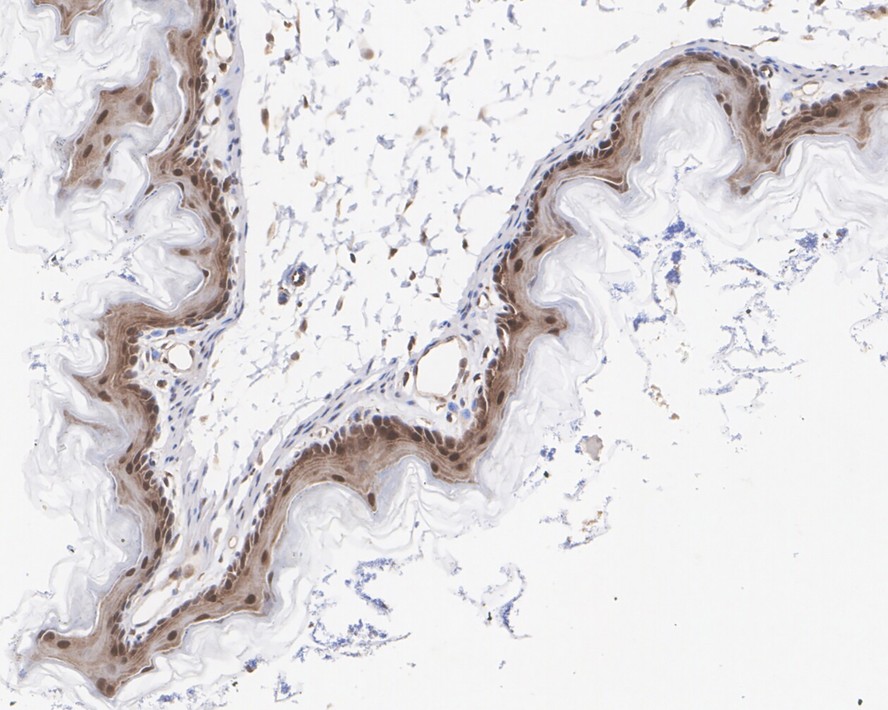 Immunohistochemical analysis of paraffin-embedded mouse esophagus tissue with Rabbit anti-ERK1 antibody (M1505-9) at 1/3,000 dilution.<br />
<br />
The section was pre-treated using heat mediated antigen retrieval with sodium citrate buffer (pH 6.0) for 2 minutes. The tissues were blocked in 1% BSA for 20 minutes at room temperature, washed with ddH2O and PBS, and then probed with the primary antibody (M1505-9) at 1/3,000 dilution for 1 hour at room temperature. The detection was performed using an HRP conjugated compact polymer system. DAB was used as the chromogen. Tissues were counterstained with hematoxylin and mounted with DPX.