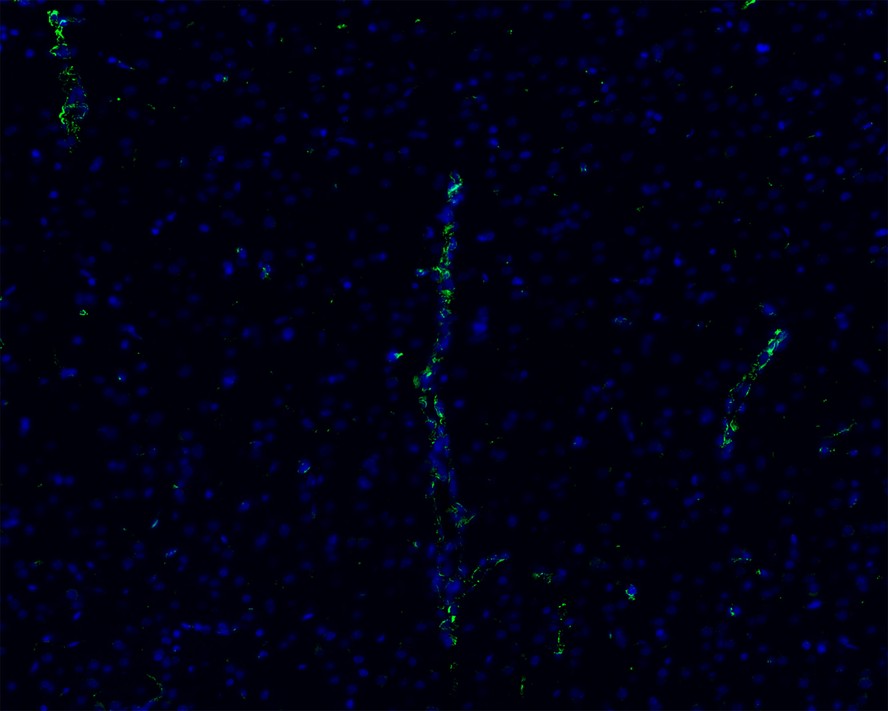 Immunofluorescence analysis of frozen mouse hippocampus tissue labeling Vimentin with Rabbit anti-Vimentin antibody (EM0401).<br />
The tissues were blocked in 3% BSA for 30 minutes at room temperature, washed with PBS, and then probed with the primary antibody (EM0401, green) at 1/100 dilution overnight at 4℃, washed with PBS. Goat Anti-Rabbit IgG H&L (Alexa Fluor® 488) was used as the secondary antibody at 1/200 dilution. Nuclei were counterstained with DAPI (blue). Image acquisition was performed with KFBIO KF-FL-400 Scanner.