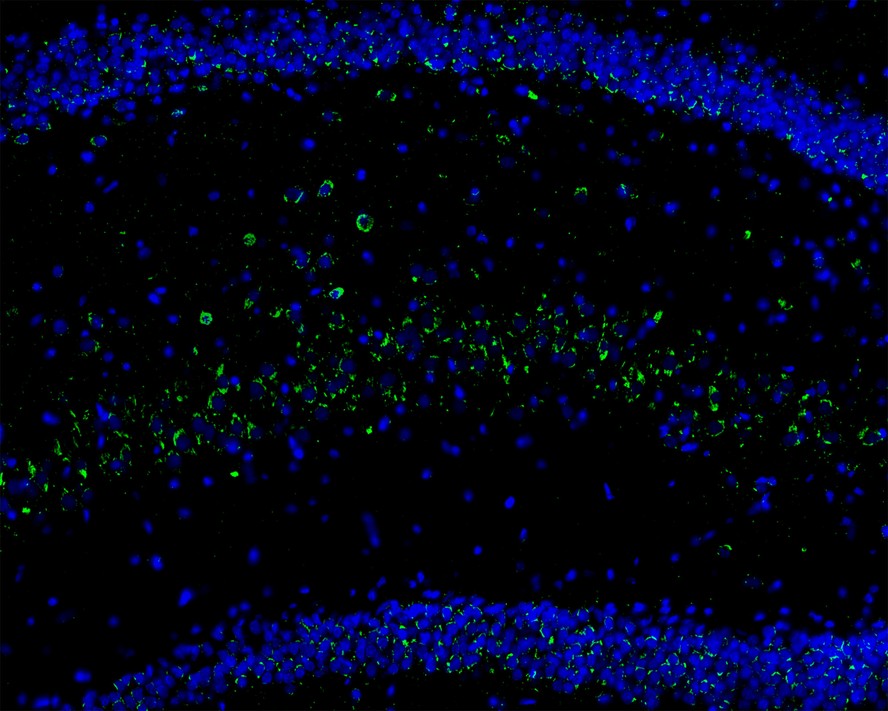 Immunofluorescence analysis of frozen mouse hippocampus tissue labeling Calretinin with Rabbit anti-Calretinin antibody (ET1705-19).<br />
<br />
The tissues were blocked in 3% BSA for 30 minutes at room temperature, washed with PBS, and then probed with the primary antibody ((ET1705-19, green) at 1/100 dilution overnight at 4℃, washed with PBS. Goat Anti-Rabbit IgG H&L (Alexa Fluor® 488) was used as the secondary antibody at 1/200 dilution. Nuclei were counterstained with DAPI (blue). Image acquisition was performed with KFBIO KF-FL-400 Scanner.