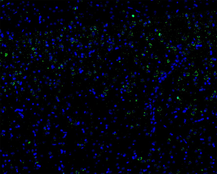Immunofluorescence analysis of frozen mouse cerebral cortex tissue labeling Calretinin with Rabbit anti-Calretinin antibody (ET1705-19).<br />
<br />
The tissues were blocked in 3% BSA for 30 minutes at room temperature, washed with PBS, and then probed with the primary antibody ((ET1705-19, green) at 1/100 dilution overnight at 4℃, washed with PBS. Goat Anti-Rabbit IgG H&L (Alexa Fluor® 488) was used as the secondary antibody at 1/200 dilution. Nuclei were counterstained with DAPI (blue). Image acquisition was performed with KFBIO KF-FL-400 Scanner.
