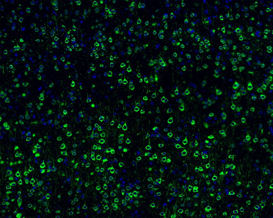 Immunofluorescence analysis of frozen mouse cerebral cortex tissue labeling Phospho-Tau(T231) with Rabbit anti-Phospho-Tau(T231) antibody (ET1610-31).<br />
The tissues were blocked in 3% BSA for 30 minutes at room temperature, washed with PBS, and then probed with the primary antibody (ET1610-31, green) at 1/100 dilution overnight at 4℃, washed with PBS. Goat Anti-Rabbit IgG H&L (Alexa Fluor® 488) was used as the secondary antibody at 1/200 dilution. Nuclei were counterstained with DAPI (blue). Image acquisition was performed with KFBIO KF-FL-400 Scanner.
