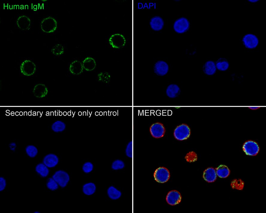 Immunocytochemistry analysis of Daudi cells labeling Human IgM with Rabbit anti-Human IgM antibody (ET1702-81) at 1/100 dilution.<br />
<br />
Cells were fixed in 80% precooled methanol for 5 minutes at room temperature, then blocked with 1% BSA in 10% negative goat serum for 1 hour at room temperature. Cells were then incubated with Rabbit anti-Human IgM antibody (ET1702-81) at 1/100 dilution in 1% BSA in PBST overnight at 4 ℃. Goat Anti-Rabbit IgG H&L (iFluor™ 488, HA1121) was used as the secondary antibody at 1/1,000 dilution. PBS instead of the primary antibody was used as the secondary antibody only control. Nuclear DNA was labelled in blue with DAPI.<br />
<br />
Beta tubulin (M1305-2, red) was stained at 1/100 dilution overnight at +4℃. Goat Anti-Mouse IgG H&L (iFluor™ 594, HA1126) was used as the secondary antibody at 1/1,000 dilution.