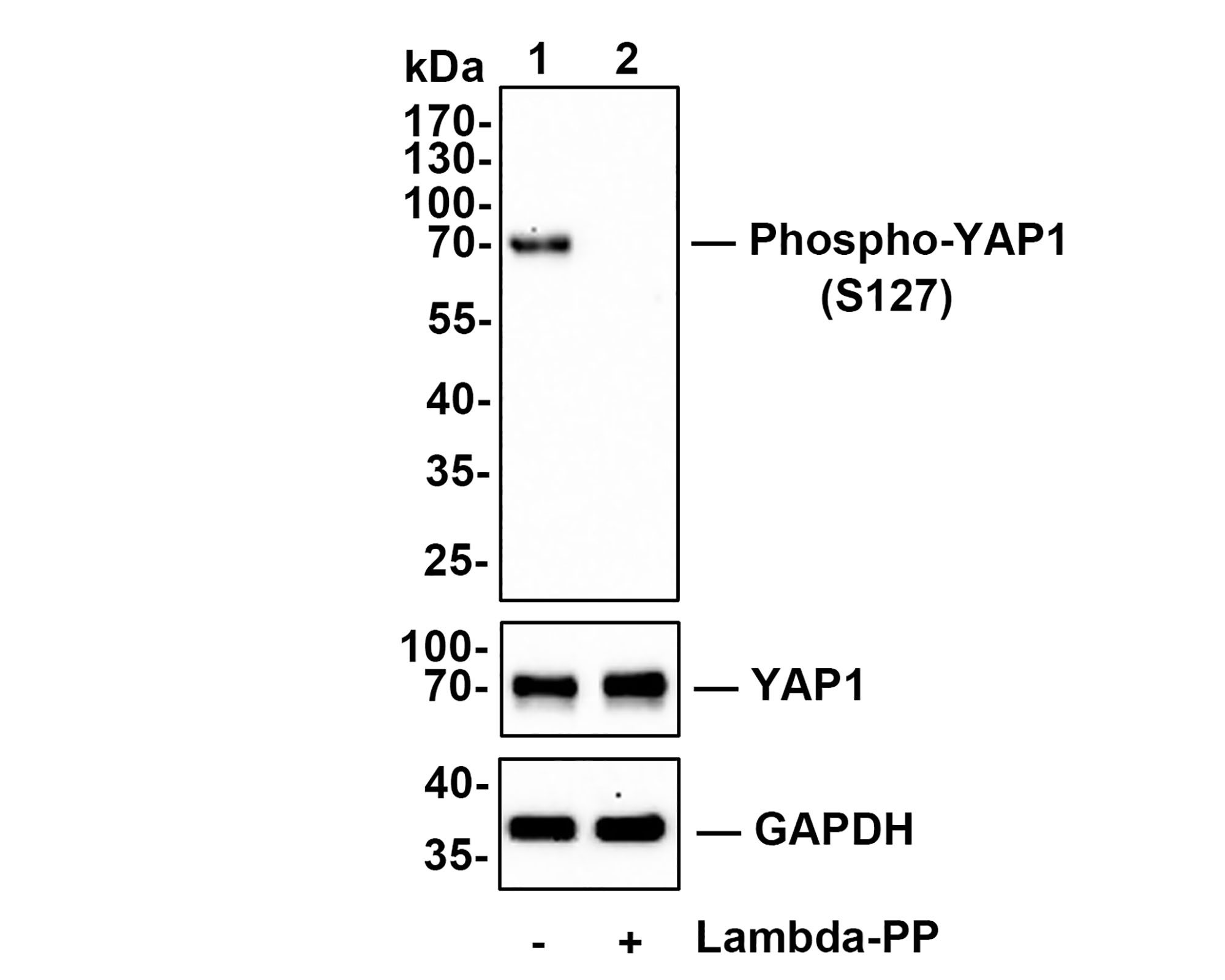 Western blot analysis of Phospho-YAP1 (S127) on SiHa cell lysates.<br />
<br />
Lane 1: SiHa cells, whole cell lysate, 10ug/lane<br />
Lane 2 : SiHa cells treated with 2.8ug/ul lambda-PP for 30 minutes, whole cell lysates, 10ug/lane<br />
<br />
All lanes :<br />
Anti-Phospho-YAP1 (S127) antibody (ET1611-69) at 1/500 dilution.  Anti-YAP1 (S127) antibody (ET1608-30) at 1/500 dilution. Anti-GAPDH antibody (ET1601-4) at 1/10,000 dilution. Goat Anti-Rabbit IgG H&L (HRP) (HA1001) at 1/200,000 dilution.<br />
<br />
Predicted band size: 54 kDa<br />
Observed band size: 70 kDa<br />
<br />
Blocking and diluting buffer: 5% BSA.<br />
<br />
Exposure time: 2 minutes 34 seconds