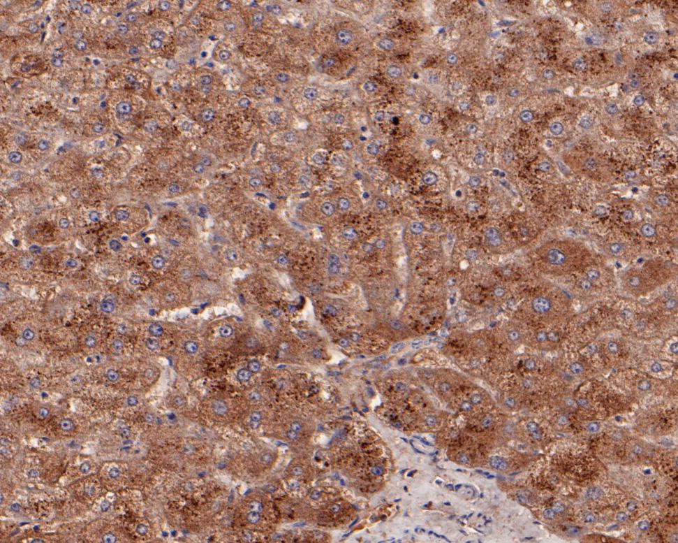 Immunohistochemical analysis of paraffin-embedded human liver tissue with Mouse anti-Phospho-mTOR (S2448) antibody (HA600094) at 1/100 dilution.<br />
<br />
The section was pre-treated using heat mediated antigen retrieval with sodium citrate buffer (pH 6.0) for 2 minutes. The tissues were blocked in 1% BSA for 20 minutes at room temperature, washed with ddH2O and PBS, and then probed with the primary antibody (HA600094) at 1/400 dilution for 1 hour at room temperature. The detection was performed using an HRP conjugated compact polymer system. DAB was used as the chromogen. Tissues were counterstained with hematoxylin and mounted with DPX.
