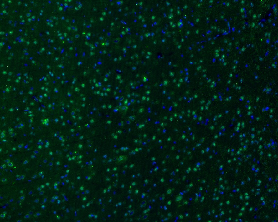 Immunofluorescence analysis of frozen mouse hippocampus tissue labeling GAD67 with Rabbit anti-GAD67 antibody (ET1703-71).<br />
<br />
The tissues were blocked in 3% BSA for 30 minutes at room temperature, washed with PBS, and then probed with the primary antibody (ET1703-71, green) at 1/50 dilution overnight at 4℃, washed with PBS. Goat Anti-Rabbit IgG H&L (Alexa Fluor® 488) was used as the secondary antibody at 1/200 dilution. Nuclei were counterstained with DAPI (blue). Image acquisition was performed with KFBIO KF-FL-400 Scanner.