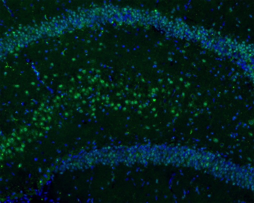 Immunofluorescence analysis of frozen mouse cerebral cortex tissue labeling GAD67 with Rabbit anti-GAD67 antibody (ET1703-71).<br />
<br />
The tissues were blocked in 3% BSA for 30 minutes at room temperature, washed with PBS, and then probed with the primary antibody (ET1703-71, green) at 1/50 dilution overnight at 4℃, washed with PBS. Goat Anti-Rabbit IgG H&L (Alexa Fluor® 488) was used as the secondary antibody at 1/200 dilution. Nuclei were counterstained with DAPI (blue). Image acquisition was performed with KFBIO KF-FL-400 Scanner.