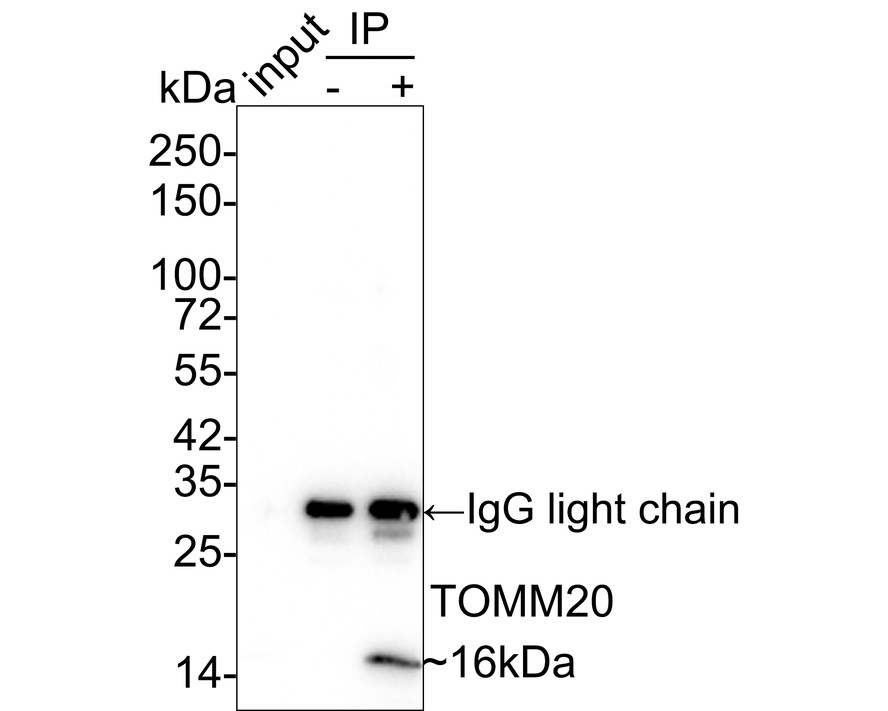 TOMM20 was immunoprecipitated in 0.2mg HeLa cell lysate with ET1609-25 at 2 µg/25 µl agarose. Western blot was performed from the immunoprecipitate using ET1609-25 at 1/1,000 dilution. Anti-Rabbit IgG for IP Nano-secondary antibody (NBI01H) at 1/5,000 dilution was used for 1 hour at room temperature.<br />
<br />
Lane 1: HeLa cell lysate (input)<br />
Lane 2: Rabbit IgG instead of ET1609-25 in HeLa cell lysate<br />
Lane 3: ET1609-25 IP in HeLa cell lysate<br />
<br />
Blocking/Dilution buffer: 5% NFDM/TBST<br />
Exposure time: 1 minute 2 seconds