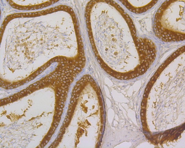 Immunohistochemical analysis of paraffin-embedded rat epididymis tissue using anti-TNFR2 antibody. The section was pre-treated using heat mediated antigen retrieval with sodium citrate buffer (pH 6.0) for 20 minutes. The tissues were blocked in 5% BSA for 30 minutes at room temperature, washed with ddH2O and PBS, and then probed with the primary antibody (HA500332, 1/50)  for 30 minutes at room temperature. The detection was performed using an HRP conjugated compact polymer system. DAB was used as the chromogen. Tissues were counterstained with hematoxylin and mounted with DPX.