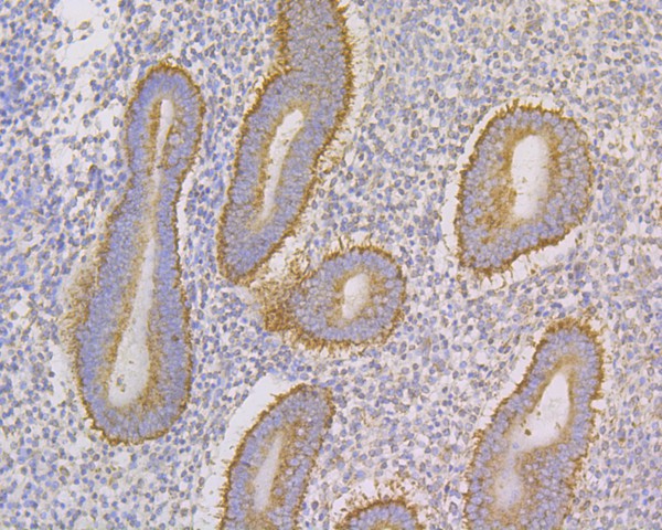Immunohistochemical analysis of paraffin-embedded human uterus tissue using anti-TNFR2 antibody. The section was pre-treated using heat mediated antigen retrieval with sodium citrate buffer (pH 6.0) for 20 minutes. The tissues were blocked in 5% BSA for 30 minutes at room temperature, washed with ddH2O and PBS, and then probed with the primary antibody (HA500332, 1/50)  for 30 minutes at room temperature. The detection was performed using an HRP conjugated compact polymer system. DAB was used as the chromogen. Tissues were counterstained with hematoxylin and mounted with DPX.