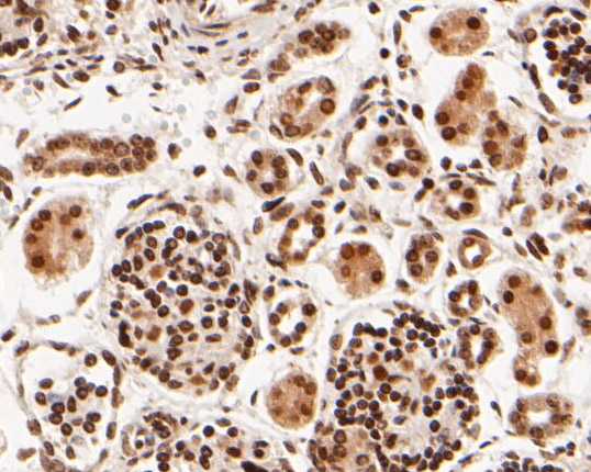 Immunohistochemical analysis of paraffin-embedded human kidney tissue using anti-SIX2 antibody. The section was pre-treated using heat mediated antigen retrieval with sodium citrate buffer (pH 6.0) for 20 minutes. The tissues were blocked in 5% BSA for 30 minutes at room temperature, washed with ddH2O and PBS, and then probed with the primary antibody (HA500463, 1/400)  for 30 minutes at room temperature. The detection was performed using an HRP conjugated compact polymer system. DAB was used as the chromogen. Tissues were counterstained with hematoxylin and mounted with DPX.