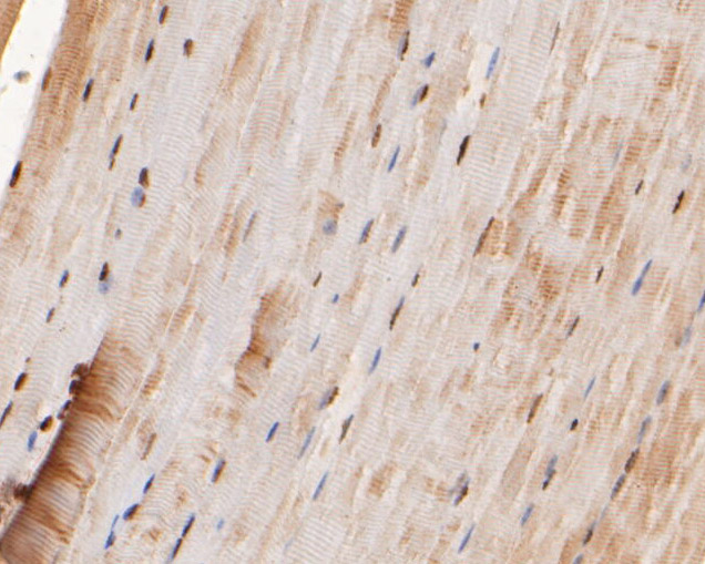 Immunohistochemical analysis of paraffin-embedded mouse  skeletal muscle tissue using anti-SIX2 antibody. The section was pre-treated using heat mediated antigen retrieval with sodium citrate buffer (pH 6.0) for 20 minutes. The tissues were blocked in 5% BSA for 30 minutes at room temperature, washed with ddH2O and PBS, and then probed with the primary antibody (HA500463, 1/400)  for 30 minutes at room temperature. The detection was performed using an HRP conjugated compact polymer system. DAB was used as the chromogen. Tissues were counterstained with hematoxylin and mounted with DPX.