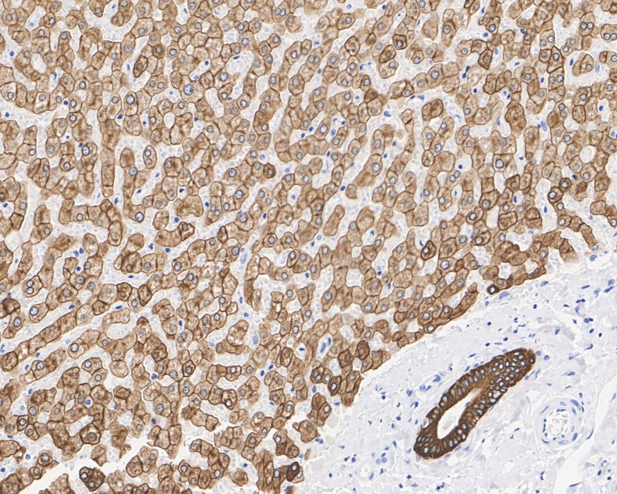 Immunohistochemical analysis of paraffin-embedded human liver tissue with Mouse anti-Cytokeratin 18 antibody (M0407-19) at 1/2,000 dilution.<br />
<br />
The section was pre-treated using heat mediated antigen retrieval with Tris-EDTA buffer (pH 9.0) for 20 minutes. The tissues were blocked in 1% BSA for 20 minutes at room temperature, washed with ddH2O and PBS, and then probed with the primary antibody (M0407-19) at 1/2,000 dilution for 1 hour at room temperature. The detection was performed using an HRP conjugated compact polymer system. DAB was used as the chromogen. Tissues were counterstained with hematoxylin and mounted with DPX.