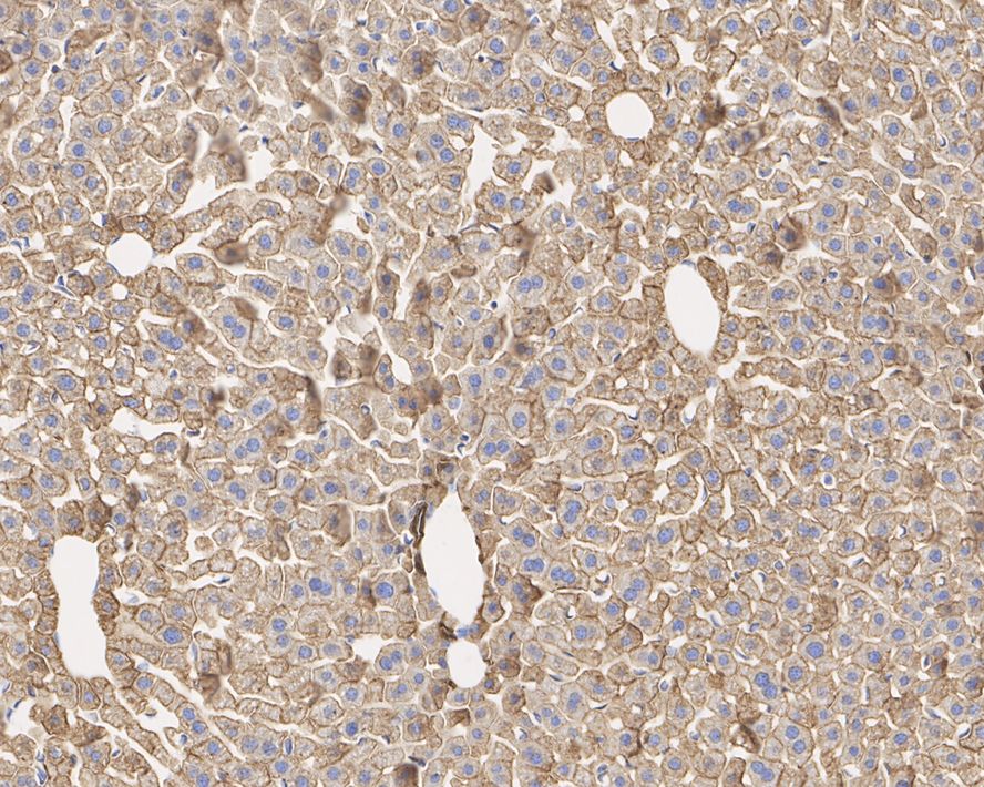 Immunohistochemical analysis of paraffin-embedded mouse liver tissue with Mouse anti-Cytokeratin 18 antibody (M0407-19) at 1/2,000 dilution.<br />
<br />
The section was pre-treated using heat mediated antigen retrieval with Tris-EDTA buffer (pH 9.0) for 20 minutes. The tissues were blocked in 1% BSA for 20 minutes at room temperature, washed with ddH2O and PBS, and then probed with the primary antibody (M0407-19) at 1/2,000 dilution for 1 hour at room temperature. The detection was performed using an HRP conjugated compact polymer system. DAB was used as the chromogen. Tissues were counterstained with hematoxylin and mounted with DPX.