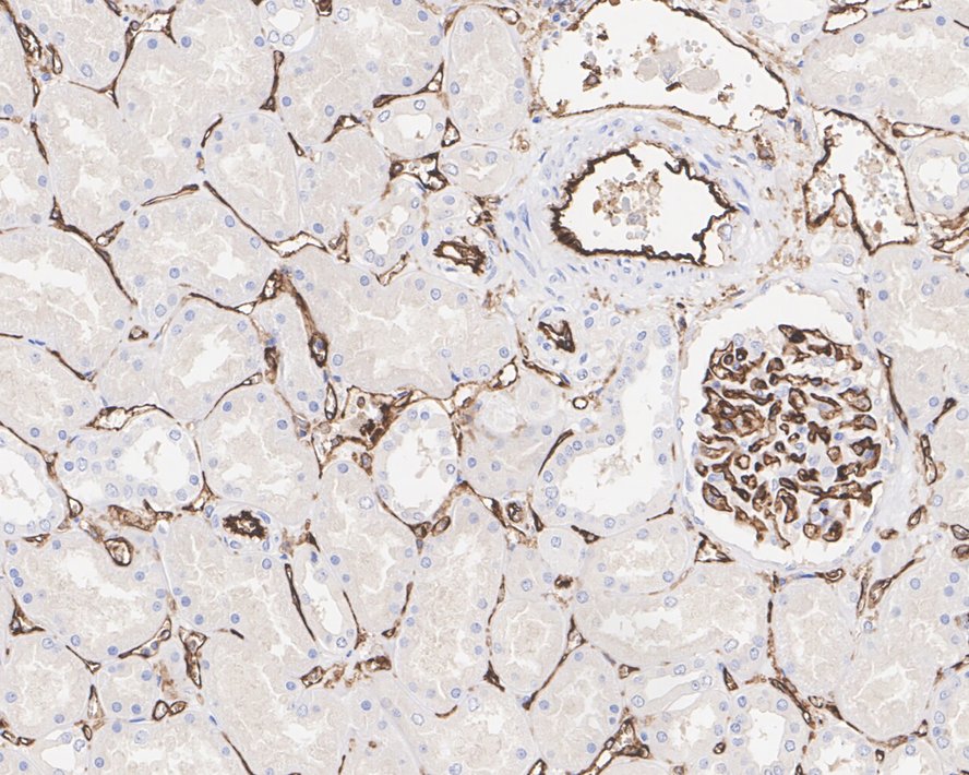 Fluorescence multiplex immunohistochemical analysis of the human gastric cancer (Formalin/PFA-fixed paraffin-embedded sections). Panel A: the merged image of anti-CD31 (M1511-8, red), anti-αSMA (ET1607-53, gray), anti-CD11b (ET1706-04, cyan), anti-panCK (HA601138, magenta) and anti-CD3 (HA720082, yellow) on human gastric cancer. Panel B: anti- CD31 stained on the endothelial cells. Panel C: anti-αSMA stained on cancer-associated fibroblasts and smooth muscle cells. Panel D: anti-CD11b stained on myeloid cells. Panel E: anti-panCK stained on cancer cells. Panel F: anti-CD3 stained on T cells. HRP Conjugated UltraPolymer Goat Polyclonal Antibody HA1119/HA1120 was used as a secondary antibody. The immunostaining was performed with the Sequential Immuno-staining Kit (IRISKit™MH010101, www.luminiris.cn). The section was incubated in five rounds of staining: in the order of M1511-8 (1/1,000 dilution), ET1607-53 (1/2,000 dilution), ET1706-04 (1/1,000 dilution), HA601138 (1/3,000 dilution), and HA720082 (1/500 dilution) for 20 mins at room temperature. Each round was followed by a separate fluorescent tyramide signal amplification system. Heat mediated antigen retrieval with Tris-EDTA buffer (pH 9.0) for 30 mins at 95C. DAPI (blue) was used as a nuclear counter stain. Image acquisition was performed with Olympus VS200 Slide Scanner.