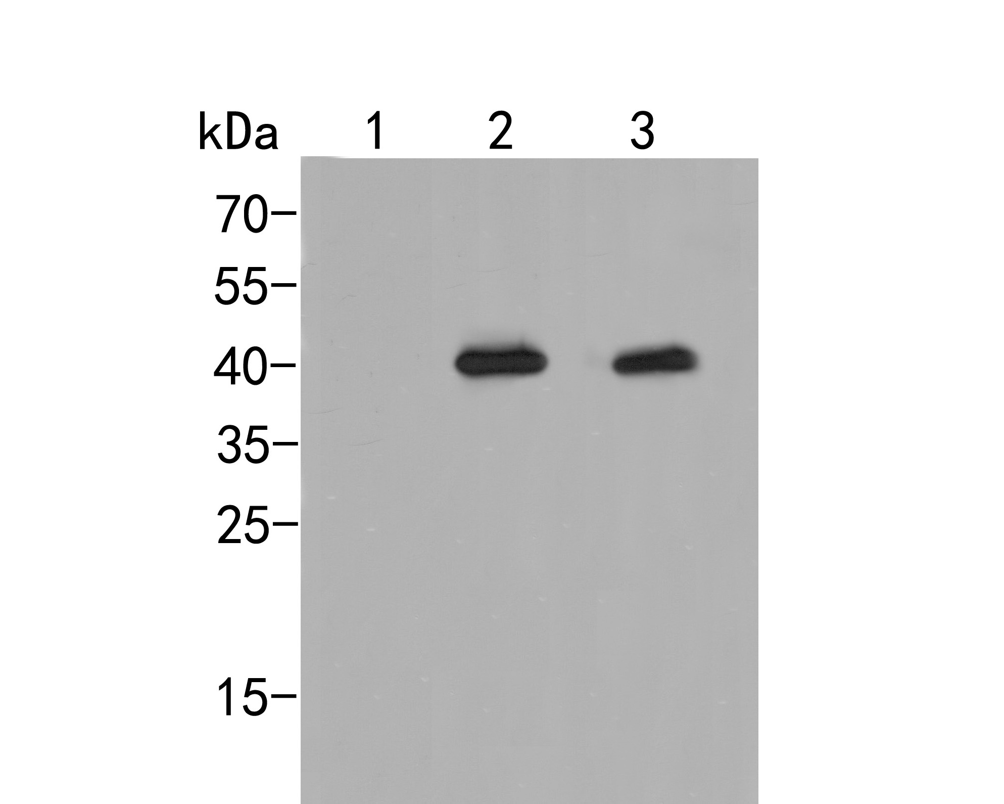 Western blot analysis of Phospho-P38  (Thr180 + Tyr182) on different lysates. Proteins were transferred to a PVDF membrane and blocked with 5% BSA in PBS for 1 hour at room temperature. The primary antibody (ER2001-52, 1/1000) was used in 5% BSA at room temperature for 2 hours. Goat Anti-Rabbit IgG - HRP Secondary Antibody (HA1001) at 1:5,000 dilution was used for 1 hour at room temperature.<br />
Positive control: <br />
Lane 1: Hela cell lysate, untreated <br />
Lane 2: Hela cell lysate, treated with UV for 40 minutes<br />
Lane 3: Hela cell lysate, treated with anisomycin at 250 ng/ml for 30 minutes