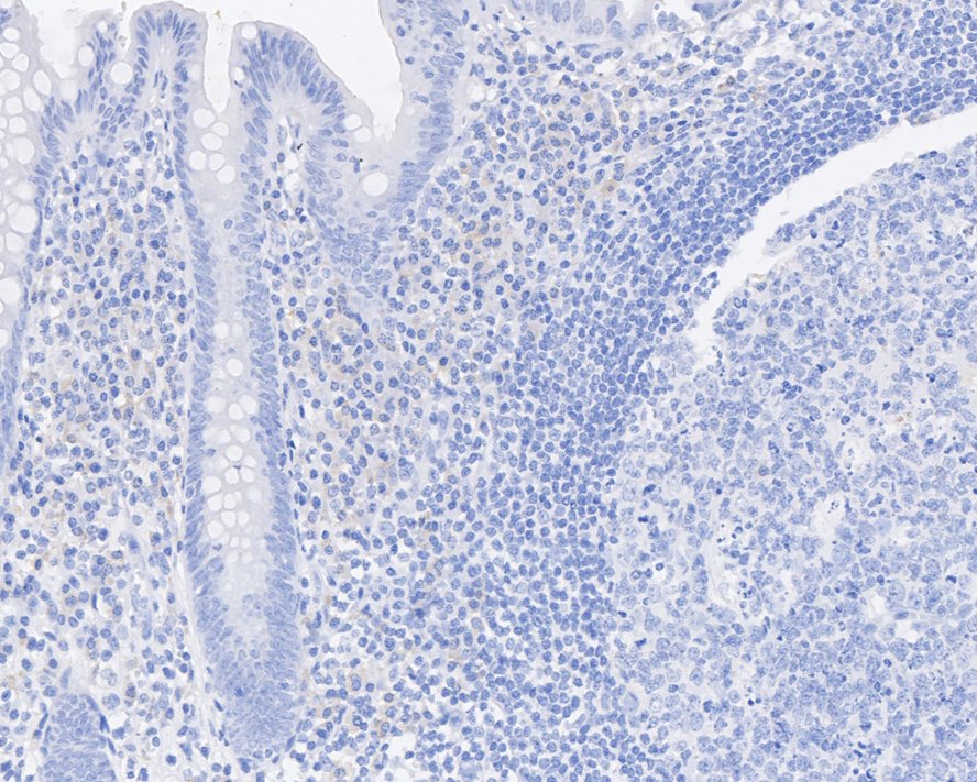 Immunohistochemical analysis of paraffin-embedded human appendix tissue (negative control) with Mouse anti-Sall4 antibody (HA601042) at 1/2,000 dilution.<br />
<br />
The section was pre-treated using heat mediated antigen retrieval with sodium citrate buffer (pH 6.0) for 2 minutes. The tissues were blocked in 1% BSA for 20 minutes at room temperature, washed with ddH2O and PBS, and then probed with the primary antibody (HA601042) at 1/2,000 dilution for 1 hour at room temperature. The detection was performed using an HRP conjugated compact polymer system. DAB was used as the chromogen. Tissues were counterstained with hematoxylin and mounted with DPX.