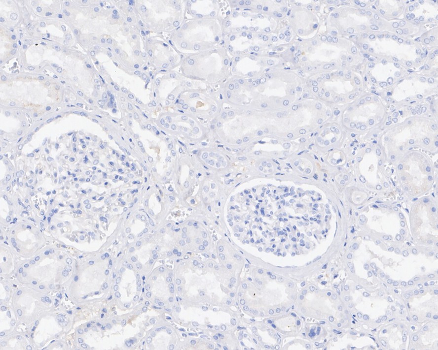 Immunohistochemical analysis of paraffin-embedded human kidney tissue (negative control) with Mouse anti-Sall4 antibody (HA601042) at 1/2,000 dilution.<br />
<br />
The section was pre-treated using heat mediated antigen retrieval with sodium citrate buffer (pH 6.0) for 2 minutes. The tissues were blocked in 1% BSA for 20 minutes at room temperature, washed with ddH2O and PBS, and then probed with the primary antibody (HA601042) at 1/2,000 dilution for 1 hour at room temperature. The detection was performed using an HRP conjugated compact polymer system. DAB was used as the chromogen. Tissues were counterstained with hematoxylin and mounted with DPX.