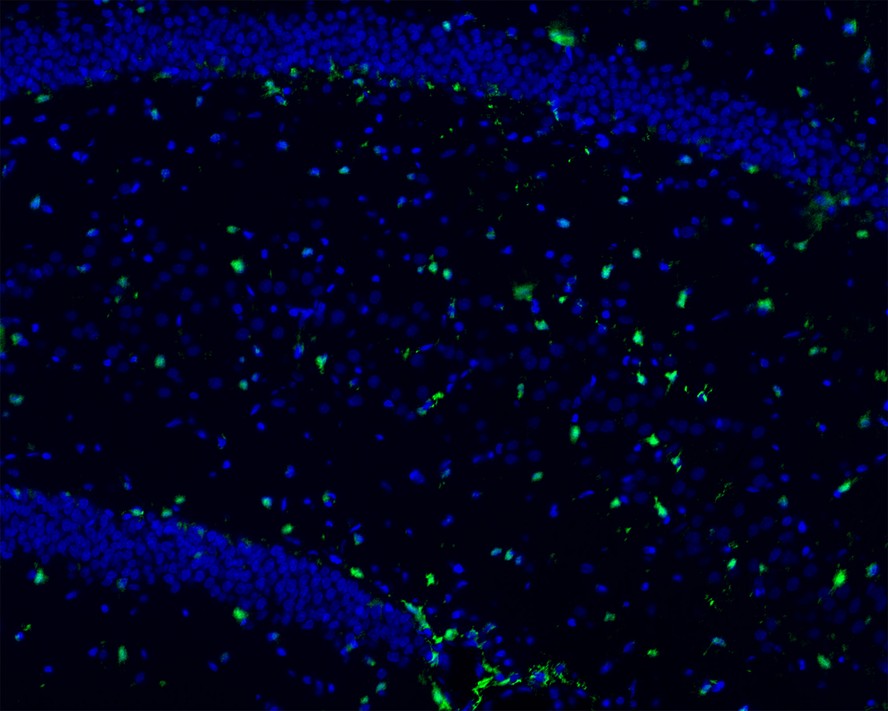 Immunofluorescence analysis of frozen mouse hippocampus tissue labeling S100 beta with Rabbit anti-S100 beta antibody (ET1610-3).<br />
The tissues were blocked in 3% BSA for 30 minutes at room temperature, washed with PBS, and then probed with the primary antibody (ET1610-3, green) at 1/100 dilution overnight at 4℃, washed with PBS. Goat Anti-Rabbit IgG H&L (Alexa Fluor® 488) was used as the secondary antibody at 1/200 dilution. Nuclei were counterstained with DAPI (blue). Image acquisition was performed with KFBIO KF-FL-400 Scanner.