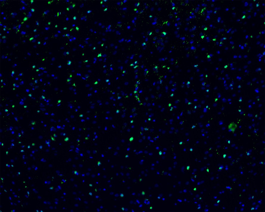 Immunofluorescence analysis of frozen mouse cerebral cortex tissue labeling S100 beta with Rabbit anti-S100 beta antibody (ET1610-3).<br />
The tissues were blocked in 3% BSA for 30 minutes at room temperature, washed with PBS, and then probed with the primary antibody (ET1610-3, green) at 1/100 dilution overnight at 4℃, washed with PBS. Goat Anti-Rabbit IgG H&L (Alexa Fluor® 488) was used as the secondary antibody at 1/200 dilution. Nuclei were counterstained with DAPI (blue). Image acquisition was performed with KFBIO KF-FL-400 Scanner.