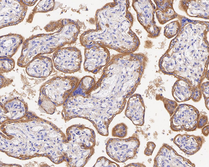 Immunohistochemical analysis of paraffin-embedded human placenta tissue with Rabbit anti-Integrin alpha V antibody (ET1610-15) at 1/1,000 dilution.<br />
<br />
The section was pre-treated using heat mediated antigen retrieval with Tris-EDTA buffer (pH 9.0) for 20 minutes. The tissues were blocked in 1% BSA for 20 minutes at room temperature, washed with ddH2O and PBS, and then probed with the primary antibody (ET1610-15) at 1/1,000 dilution for 1 hour at room temperature. The detection was performed using an HRP conjugated compact polymer system. DAB was used as the chromogen. Tissues were counterstained with hematoxylin and mounted with DPX.