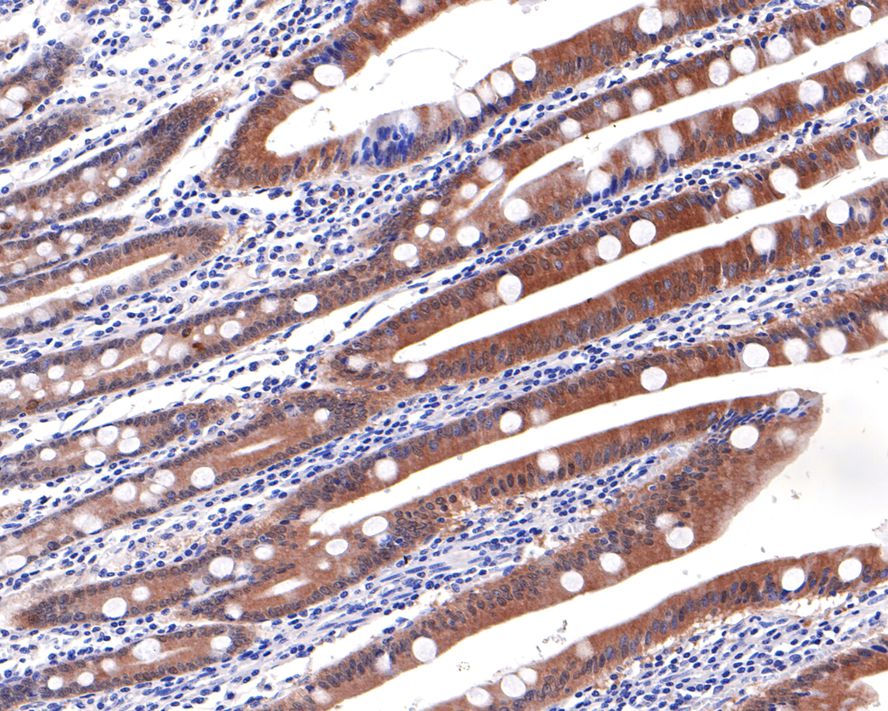 Immunohistochemical analysis of paraffin-embedded human small intestine tissue with Rabbit anti-Caspase-6 antibody (ET1610-24) at 1/400 dilution.<br />
<br />
The section was pre-treated using heat mediated antigen retrieval with Tris-EDTA buffer (pH 9.0) for 20 minutes. The tissues were blocked in 1% BSA for 20 minutes at room temperature, washed with ddH2O and PBS, and then probed with the primary antibody (ET1610-24) at 1/400 dilution for 1 hour at room temperature. The detection was performed using an HRP conjugated compact polymer system. DAB was used as the chromogen. Tissues were counterstained with hematoxylin and mounted with DPX.