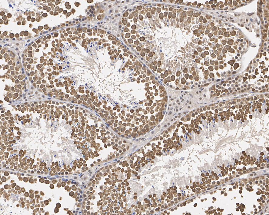 Immunohistochemical analysis of paraffin-embedded mouse testis tissue with Mouse anti-RUVB2 antibody (EM1901-58) at 1/1,000 dilution.<br />
<br />
The section was pre-treated using heat mediated antigen retrieval with sodium citrate buffer (pH 6.0) for 2 minutes. The tissues were blocked in 1% BSA for 20 minutes at room temperature, washed with ddH2O and PBS, and then probed with the primary antibody (EM1901-58) at 1/1,000 dilution for 1 hour at room temperature. The detection was performed using an HRP conjugated compact polymer system. DAB was used as the chromogen. Tissues were counterstained with hematoxylin and mounted with DPX.
