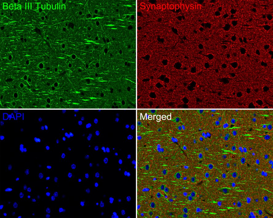 Immunofluorescence analysis of paraffin-embedded rat brain tissue labeling Beta III Tubulin (M0805-8) and Synaptophysin (ET1606-56).<br />
<br />
The section was pre-treated using heat mediated antigen retrieval with Tris-EDTA buffer (pH 9.0) for 20 minutes. The tissues were blocked in 10% negative goat serum for 1 hour at room temperature, washed with PBS. And then probed with the primary antibodies Beta III Tubulin (M0805-8, green) at 1/200 dilution and Synaptophysin (ET1606-56, red) at 1/200 dilution overnight at 4 ℃, washed with PBS.<br />
<br />
Alexa Fluor® 488 conjugate-Goat anti-Mouse IgG and Alexa Fluor® 594 conjugate-Goat anti-Rabbit IgG were used as the secondary antibodies at 1/500 dilution. DAPI was used as nuclear counterstain.