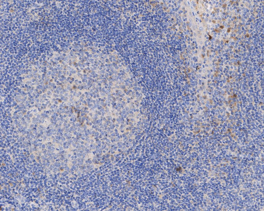 Immunohistochemical analysis of paraffin-embedded human tonsil tissue with Mouse anti-IL-1 beta antibody (HA601036) at 1/100 dilution.<br />
<br />
The section was pre-treated using heat mediated antigen retrieval with Tris-EDTA buffer (pH 9.0) for 20 minutes. The tissues were blocked in 1% BSA for 20 minutes at room temperature, washed with ddH2O and PBS, and then probed with the primary antibody (HA601036) at 1/100 dilution for 1 hour at room temperature. The detection was performed using an HRP conjugated compact polymer system. DAB was used as the chromogen. Tissues were counterstained with hematoxylin and mounted with DPX.
