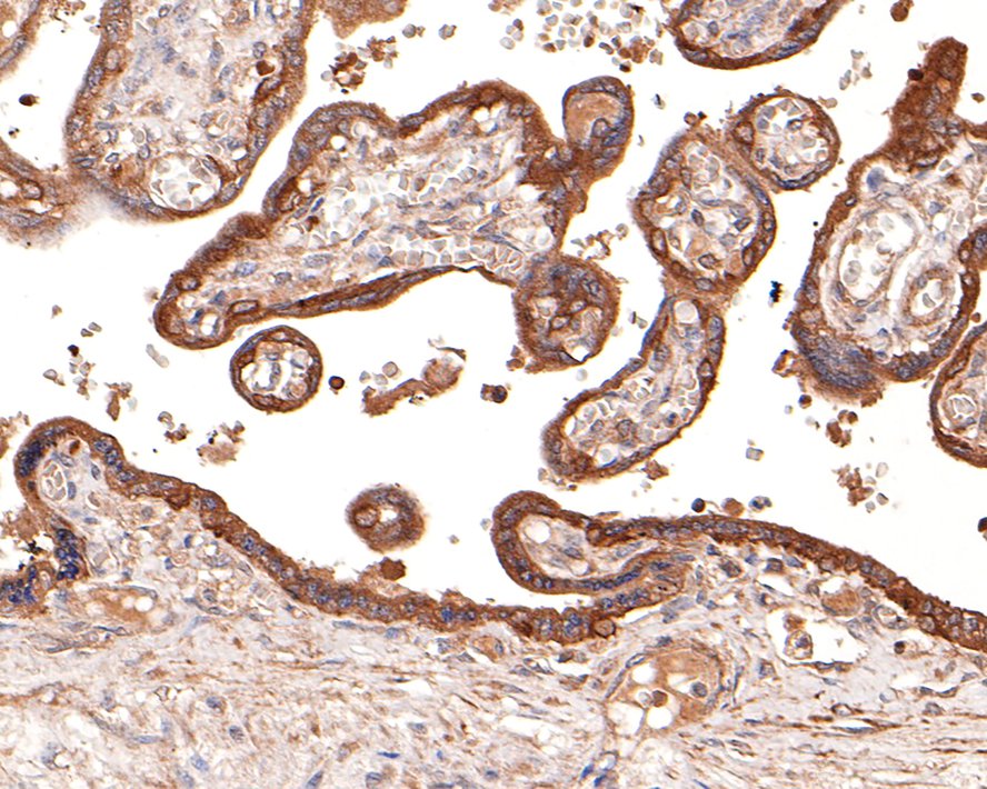 Immunohistochemical analysis of paraffin-embedded human placenta tissue with Rabbit anti-Active Caspase-3 antibody (ET1602-47) at 1/100 dilution.<br />
<br />
The section was pre-treated using heat mediated antigen retrieval with Tris-EDTA buffer (pH 9.0) for 20 minutes. The tissues were blocked in 1% BSA for 20 minutes at room temperature, washed with ddH2O and PBS, and then probed with the primary antibody (ET1602-47) at 1/100 dilution for 1 hour at room temperature. The detection was performed using an HRP conjugated compact polymer system. DAB was used as the chromogen. Tissues were counterstained with hematoxylin and mounted with DPX.