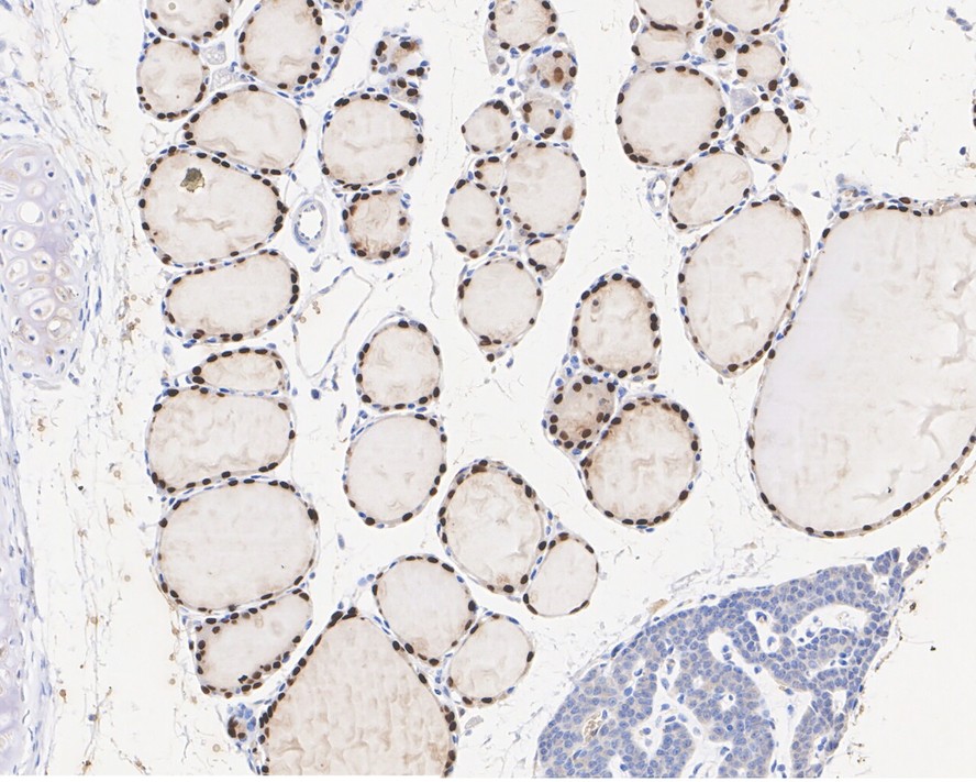 Immunohistochemical analysis of paraffin-embedded mouse thyroid tissue with Mouse anti-PAX8 antibody (EM1701-81) at 1/2,000 dilution.<br />
<br />
The section was pre-treated using heat mediated antigen retrieval with sodium citrate buffer (pH 6.0) for 2 minutes. The tissues were blocked in 1% BSA for 20 minutes at room temperature, washed with ddH2O and PBS, and then probed with the primary antibody (EM1701-81) at 1/2,000 dilution for 1 hour at room temperature. The detection was performed using an HRP conjugated compact polymer system. DAB was used as the chromogen. Tissues were counterstained with hematoxylin and mounted with DPX.