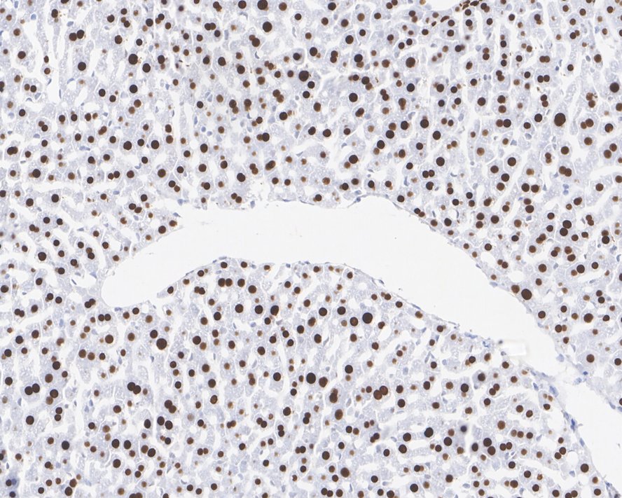 Immunohistochemical analysis of paraffin-embedded mouse liver tissue with Rabbit anti-FOXA1 antibody (ET1702-89) at 1/500 dilution.<br />
<br />
The section was pre-treated using heat mediated antigen retrieval with sodium citrate buffer (pH 6.0) for 2 minutes. The tissues were blocked in 1% BSA for 20 minutes at room temperature, washed with ddH2O and PBS, and then probed with the primary antibody (ET1702-89) at 1/500 dilution for 1 hour at room temperature. The detection was performed using an HRP conjugated compact polymer system. DAB was used as the chromogen. Tissues were counterstained with hematoxylin and mounted with DPX.