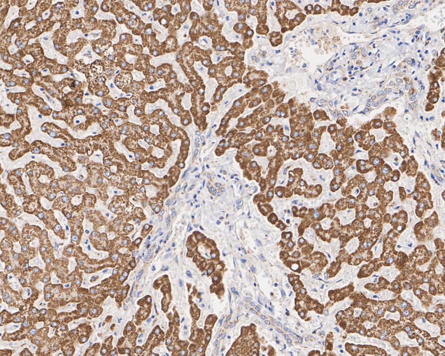 Immunohistochemical analysis of paraffin-embedded human liver tissue with Mouse anti-ALDH2 antibody (M1501-7) at 1/2,000 dilution.<br />
<br />
The section was pre-treated using heat mediated antigen retrieval with Tris-EDTA buffer (pH 9.0) for 20 minutes. The tissues were blocked in 1% BSA for 20 minutes at room temperature, washed with ddH2O and PBS, and then probed with the primary antibody (M1501-7) at 1/2,000 dilution for 1 hour at room temperature. The detection was performed using an HRP conjugated compact polymer system. DAB was used as the chromogen. Tissues were counterstained with hematoxylin and mounted with DPX.