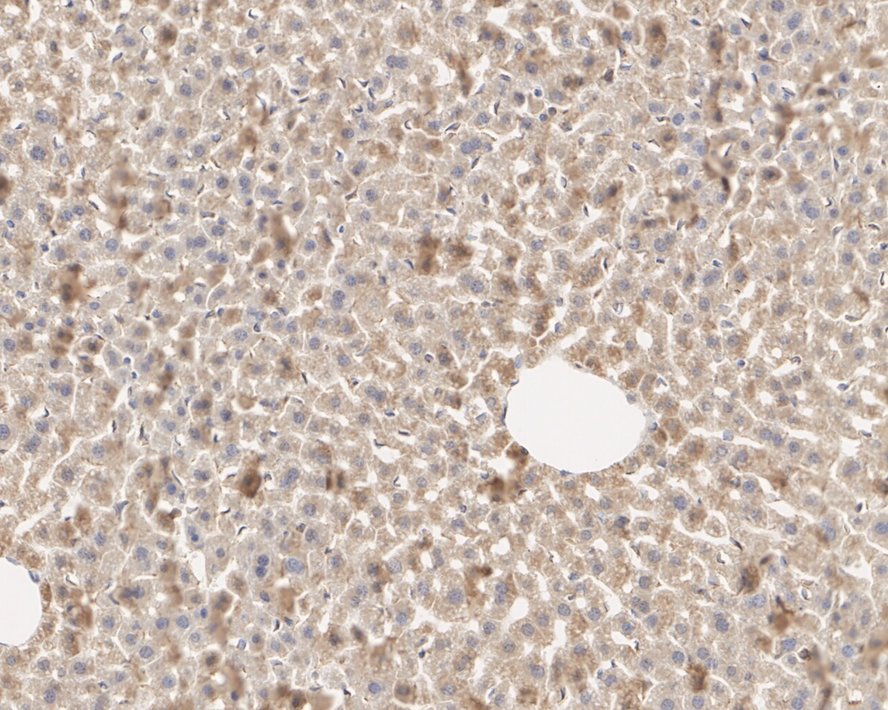 Immunohistochemical analysis of paraffin-embedded mouse liver tissue with Mouse anti-ALDH2 antibody (M1501-7) at 1/500 dilution.<br />
<br />
The section was pre-treated using heat mediated antigen retrieval with Tris-EDTA buffer (pH 9.0) for 20 minutes. The tissues were blocked in 1% BSA for 20 minutes at room temperature, washed with ddH2O and PBS, and then probed with the primary antibody (M1501-7) at 1/500 dilution for 1 hour at room temperature. The detection was performed using an HRP conjugated compact polymer system. DAB was used as the chromogen. Tissues were counterstained with hematoxylin and mounted with DPX.