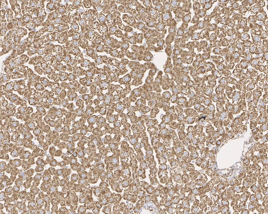 Immunohistochemical analysis of paraffin-embedded rat liver tissue with Mouse anti-ALDH2 antibody (M1501-7) at 1/2,000 dilution.<br />
<br />
The section was pre-treated using heat mediated antigen retrieval with Tris-EDTA buffer (pH 9.0) for 20 minutes. The tissues were blocked in 1% BSA for 20 minutes at room temperature, washed with ddH2O and PBS, and then probed with the primary antibody (M1501-7) at 1/2,000 dilution for 1 hour at room temperature. The detection was performed using an HRP conjugated compact polymer system. DAB was used as the chromogen. Tissues were counterstained with hematoxylin and mounted with DPX.