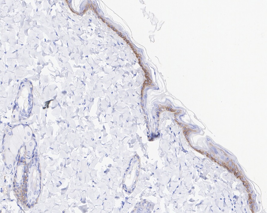 Immunohistochemical analysis of paraffin-embedded rat skin tissue with Rabbit anti-Collagen XVII antibody (ET1602-14) at 1/200 dilution.<br />
<br />
The section was pre-treated using heat mediated antigen retrieval with Tris-EDTA buffer (pH 9.0) for 20 minutes. The tissues were blocked in 1% BSA for 20 minutes at room temperature, washed with ddH2O and PBS, and then probed with the primary antibody (ET1602-14) at 1/200 dilution for 1 hour at room temperature. The detection was performed using an HRP conjugated compact polymer system. DAB was used as the chromogen. Tissues were counterstained with hematoxylin and mounted with DPX.