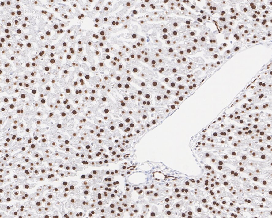 Immunohistochemical analysis of paraffin-embedded rat liver tissue with Rabbit anti-FOXA1 antibody (ET1702-89) at 1/500 dilution.<br />
<br />
The section was pre-treated using heat mediated antigen retrieval with sodium citrate buffer (pH 6.0) for 2 minutes. The tissues were blocked in 1% BSA for 20 minutes at room temperature, washed with ddH2O and PBS, and then probed with the primary antibody (ET1702-89) at 1/500 dilution for 1 hour at room temperature. The detection was performed using an HRP conjugated compact polymer system. DAB was used as the chromogen. Tissues were counterstained with hematoxylin and mounted with DPX.