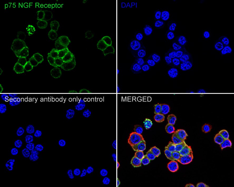 iFluor™ 488 Conjugated p75 NGF Receptor Recombinant Rabbit Monoclonal ...