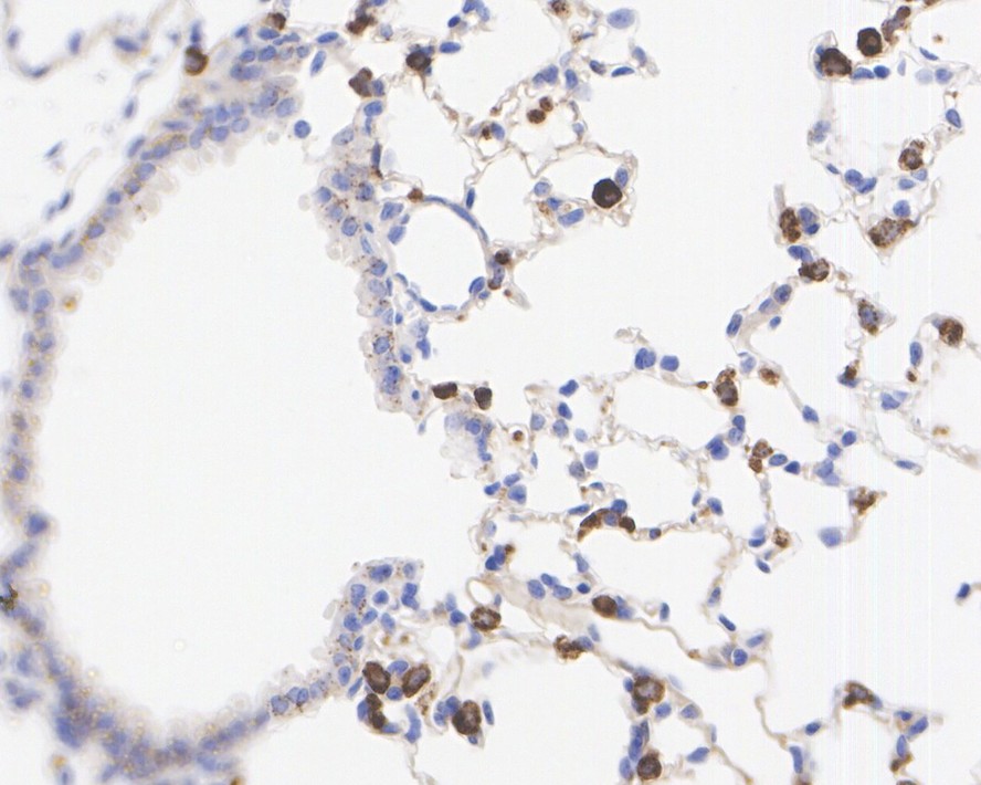 Immunohistochemical analysis of paraffin-embedded human kidney tissue with Rabbit anti-Lysozyme antibody (ET1609-35) at 1/500 dilution.<br />
<br />
The section was pre-treated using heat mediated antigen retrieval with Tris-EDTA buffer (pH 9.0) for 20 minutes. The tissues were blocked in 1% BSA for 20 minutes at room temperature, washed with ddH2O and PBS, and then probed with the primary antibody (ET1609-35) at 1/500 dilution for 1 hour at room temperature. The detection was performed using an HRP conjugated compact polymer system. DAB was used as the chromogen. Tissues were counterstained with hematoxylin and mounted with DPX.