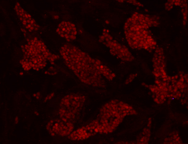 ICC staining UTF1 in D3 cells (red). Cells were fixed in paraformaldehyde, permeabilised with 0.25% Triton X100/PBS.
