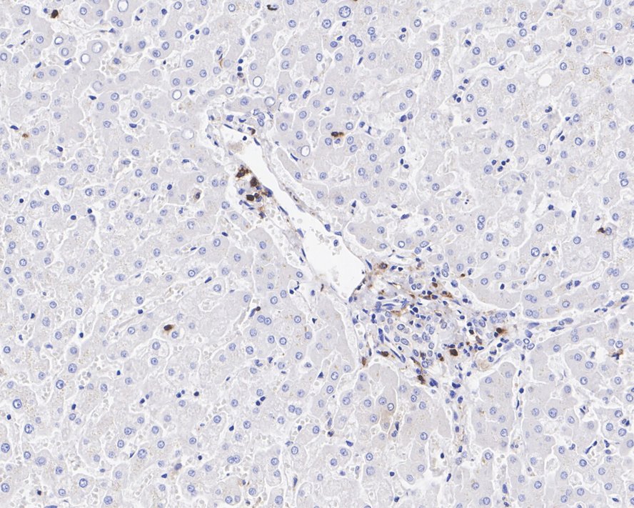 Immunohistochemical analysis of paraffin-embedded human liver tissue with Rabbit anti-CD11c antibody (ET1606-19) at 1/800 dilution.<br />
<br />
The section was pre-treated using heat mediated antigen retrieval with Tris-EDTA buffer (pH 9.0) for 20 minutes. The tissues were blocked in 1% BSA for 20 minutes at room temperature, washed with ddH2O and PBS, and then probed with the primary antibody (ET1606-19) at 1/800 dilution for 1 hour at room temperature. The detection was performed using an HRP conjugated compact polymer system. DAB was used as the chromogen. Tissues were counterstained with hematoxylin and mounted with DPX.